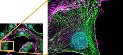 Images acquired using an X Line UPLXAPO60XO objective lens.