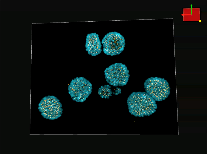 3D epithelial breast cancer spheroids. DAPI (blue), pericentrin (yellow).