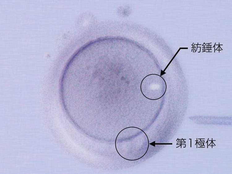 IX3顕微鏡（ICSI） | Evident Scientific | Olympus