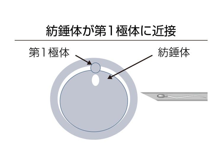 紡錘体が第1極体に近接
