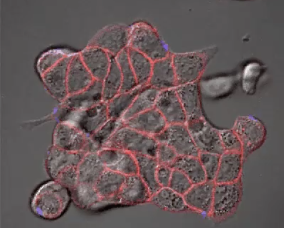 Cetuximab: Alexa Fluor 647 antibody drug (red). Natural Killer cells: ZsGreen (green). Detection of dead cells: DAPI (blue).