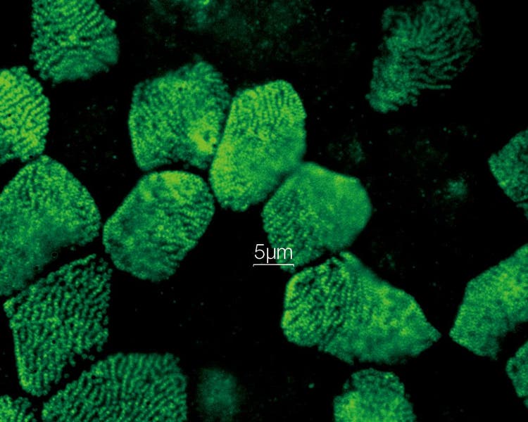 IXplore IX83 SpinSR 超解像顕微鏡システム | Evident Scientific