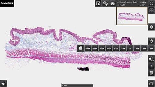 無料のOlyaVIAバーチャルスライドビューワーと連携