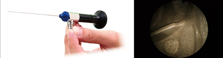 直接目視不可かつ観察箇所までストレートな場合