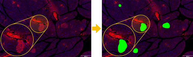 효율적으로 형태적 특징 분할