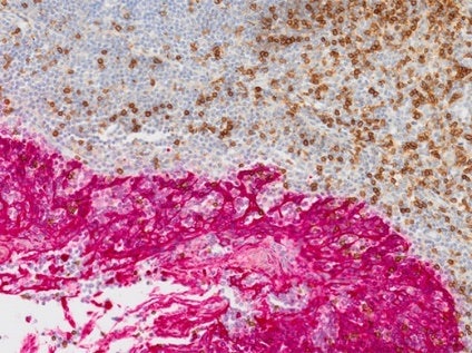 암 및 줄기세포 연구