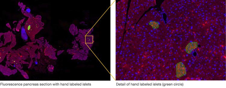 This was created by hand labeling the islets of twelve different mouse pancreas samples (green circle).