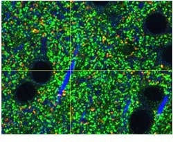 UPLASAPO60XS2, Z=35μm