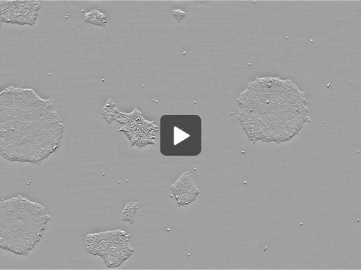 induced Pluripotent Stem cells