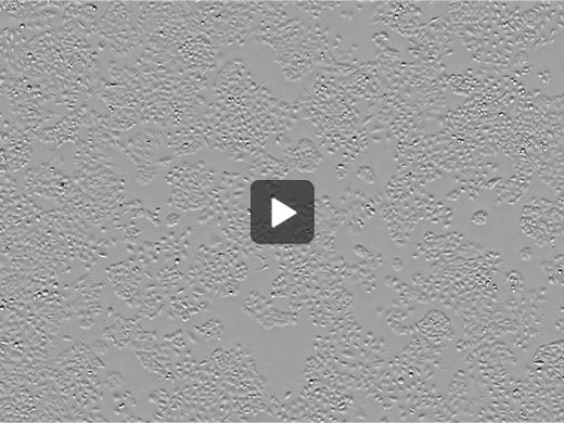 Adenocarcinomic human alveolar basal epithelial cells