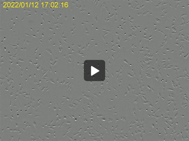 Normal Human Dermal Fibroblasts