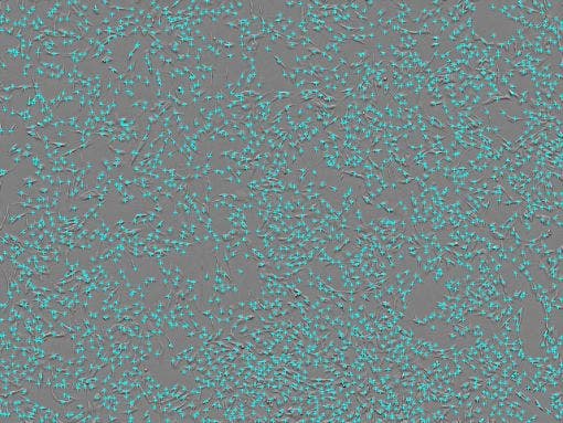 Cell count : 2.77 × 10³