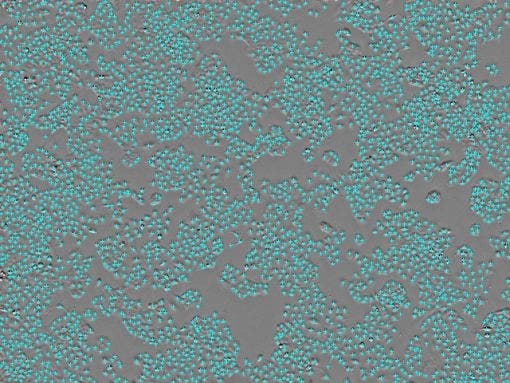 Cell count : 3.42 × 10³