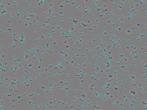 Cell count : 5.71 × 10²