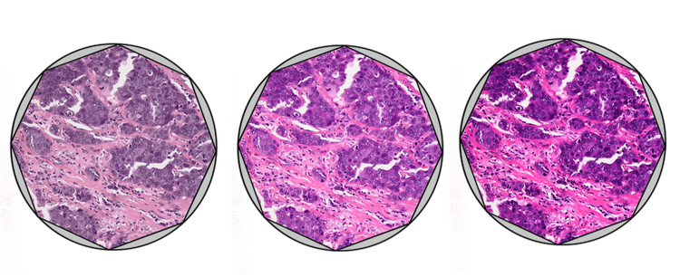 쾰러 조명법 정렬 시 구경 조리개가 너무 넓거나, 적절하거나, 너무 좁은 경우의 이미지 품질 비교