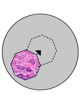 쾰러 조명법에서 시야 조리개를 가운데로 놓는 방법을 보여주는 그림
