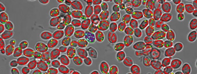 Yeasts imaged with the scanR high-content screening system and analyzed with TruAI deep-learning technology.