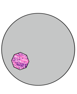 쾰러 조명법에서 시야 조리개를 닫는 방법을 보여주는 그림