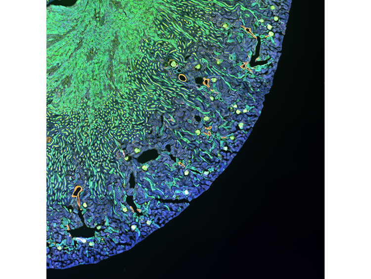 마우스 신장의 적용 이미지