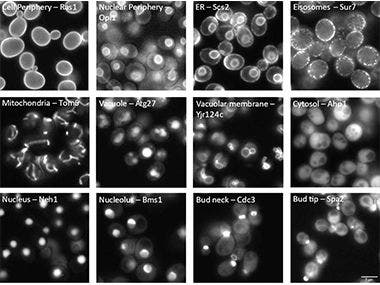 Yeast Protein Localization Classified Using TruAI™ Deep-Learning Technology