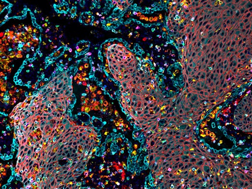 인간 생물지표 다중화를 위한 ULTIVUE Ultimapper™ 키트