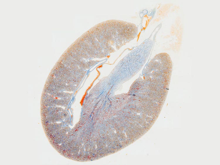 다중 이미지 정렬 (MIA) 기능을 사용하여 생성