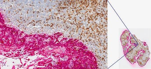 뛰어난 스티칭 정확도