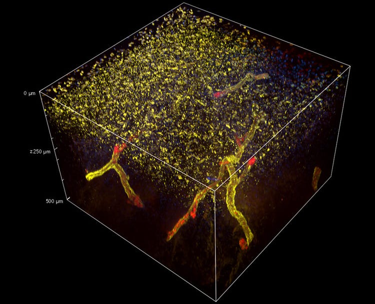 3D view of a Mammary Gland