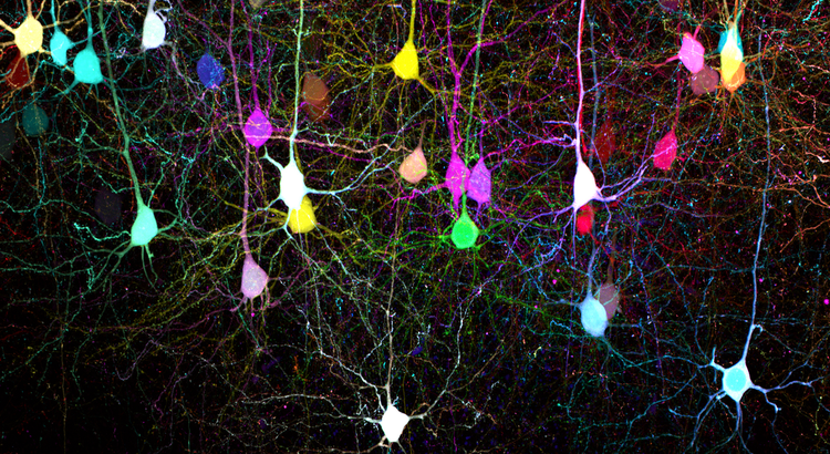 Mouse brain slice expressing 7-color Tetbow cleared with SeeDB2.