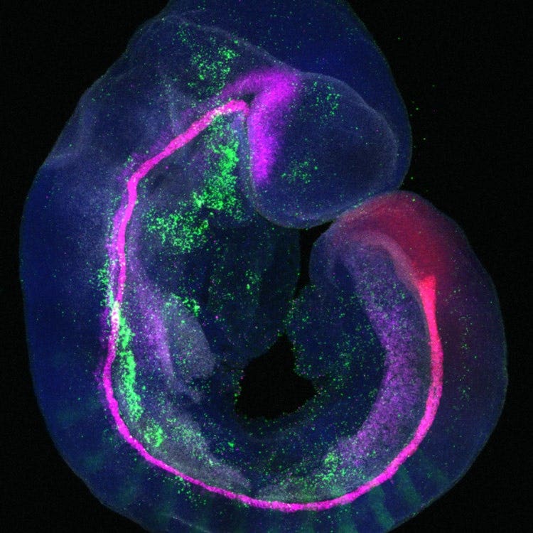 High-resolution five-channel confocal image of an embryo