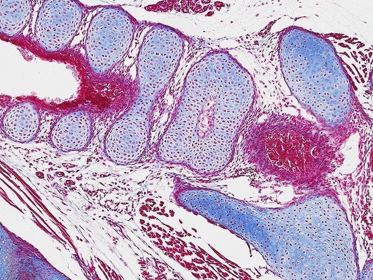Specimen: Mouse Embryo (bone); Microscope: CX23, Objective: Plan Achromat 10x (NA 0.25), TV-Adaptor: U-TV0.5XC-3, Illumination: Brightfield (LED), Exposure time: 1.3 ms