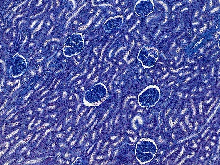 Specimen: Kidney glumeruli; Microscope: CX23, Objective: Plan Achromat 10x (NA 0.25), TV-Adaptor: U-TV0.5XC-3, Illumination: Brightfield (LED), Exposure time: 2 ms