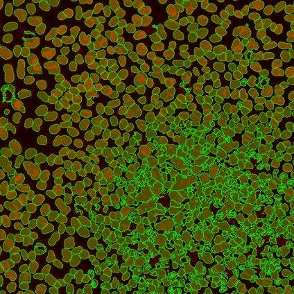 standard threshold segmentation (middle)