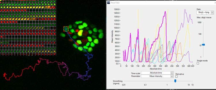 hES cells expressing FUCC (CA) biosensor. Courtesy of Dr. Silvia Santos, The Francis Crick Institute, London, UK.