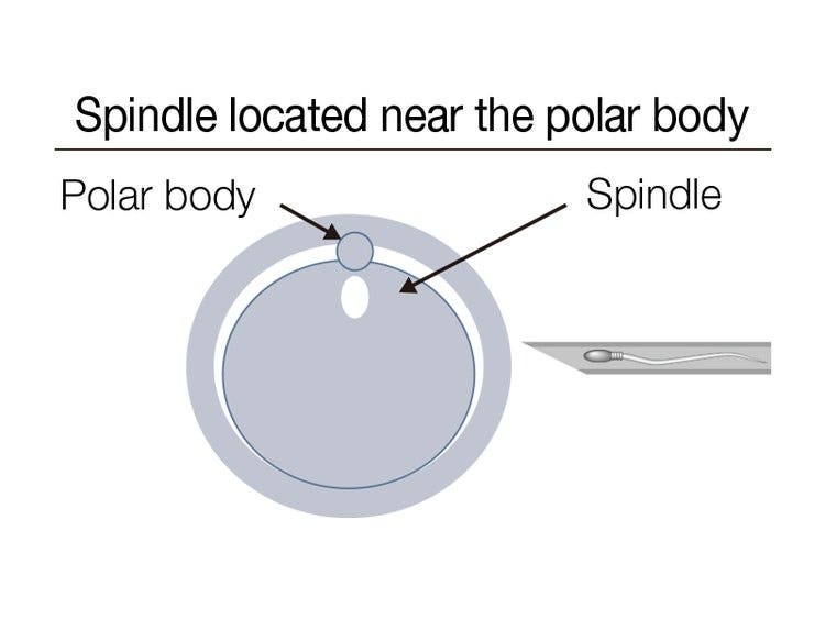 Spindle located near the polar body
