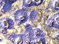 Spheroidal graphite cast iron - DIC