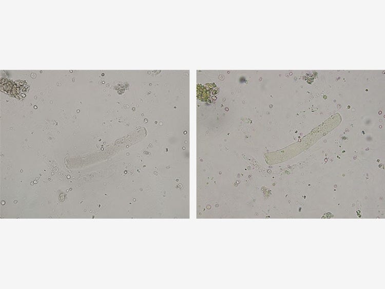 Left: CX41 with the aperture stop closed and condenser down / Right: CX43 with the aperture stop closed /Sample: waxy cylinder