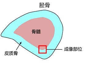 图1：胫骨切片示例