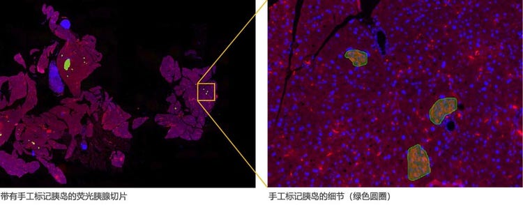 带有手工标记胰岛的荧光胰腺切片 / 手工标记胰岛的细节（绿色圆圈）