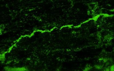 Fluorescence image (10x objective lens; excitation light set to B state)