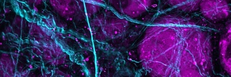 二次谐波（SHG）和三次谐波（THG）显微成像