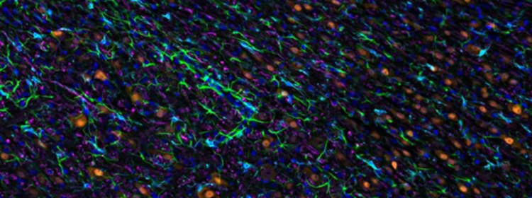 Wie die räumliche Biologie die Forschung verändert und innoviert