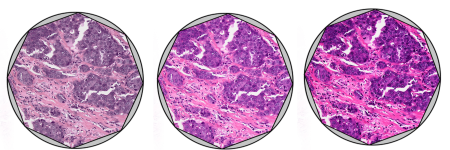 How to Align Köhler Illumination in 6 Simple Steps