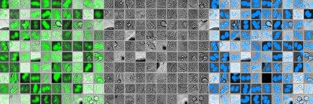 使用深度学习技术进行的准确细胞核检测