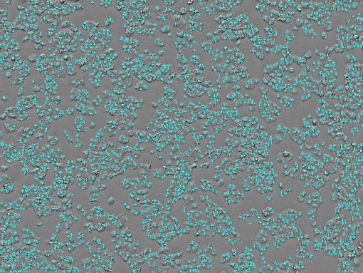 Cell count : 2.62 × 10³