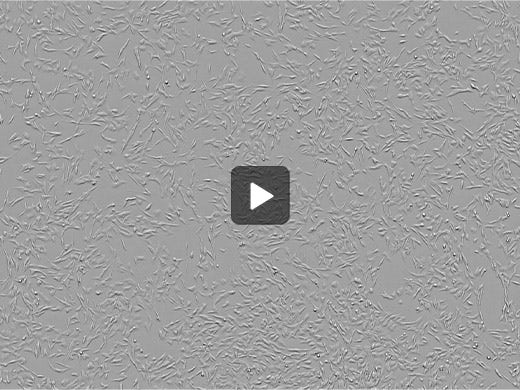 Neuroblastoma * Acquire with custom mode