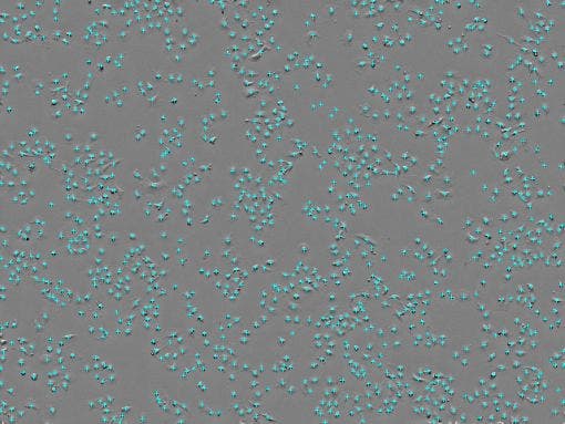 Cell count : 1.18 × 10³