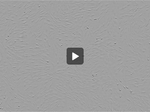 Normal Human Dermal Fibroblasts