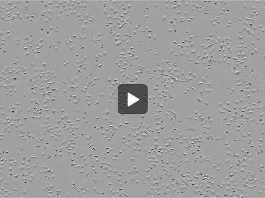 Fluorouracil (5-FU) added