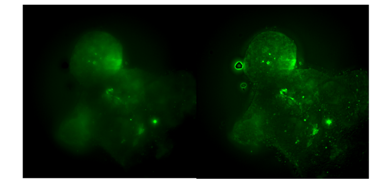 An organoid (GFP) derived from a human colon cancer patient, shown with 3D deconvolution in the right image.